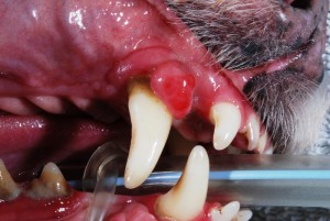 Oral Tumor1